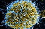 Design competition seeks ideas in fight against disease epidemics